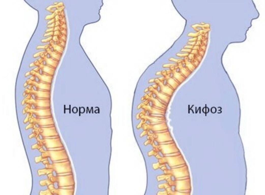 Даже не видя лица, можно предположить возраст человека по его осанке. Только грустно, когда думаешь, что женщине за 50, а по паспорту она на 10 лет младше.-2