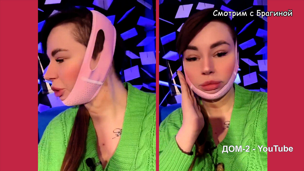 Элина рахимова фото до и после пластики