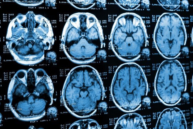     Ученые выяснили, как пристрастие к кокаину убивает мозг человека