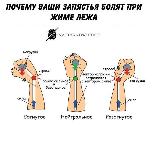 После зала болит запястье