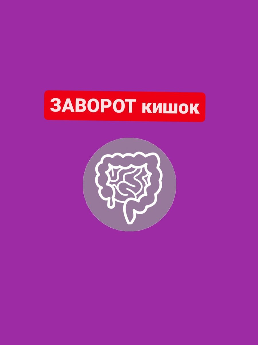 Заворот кишок Причины. Симптомы | Кратко. По сути | Дзен