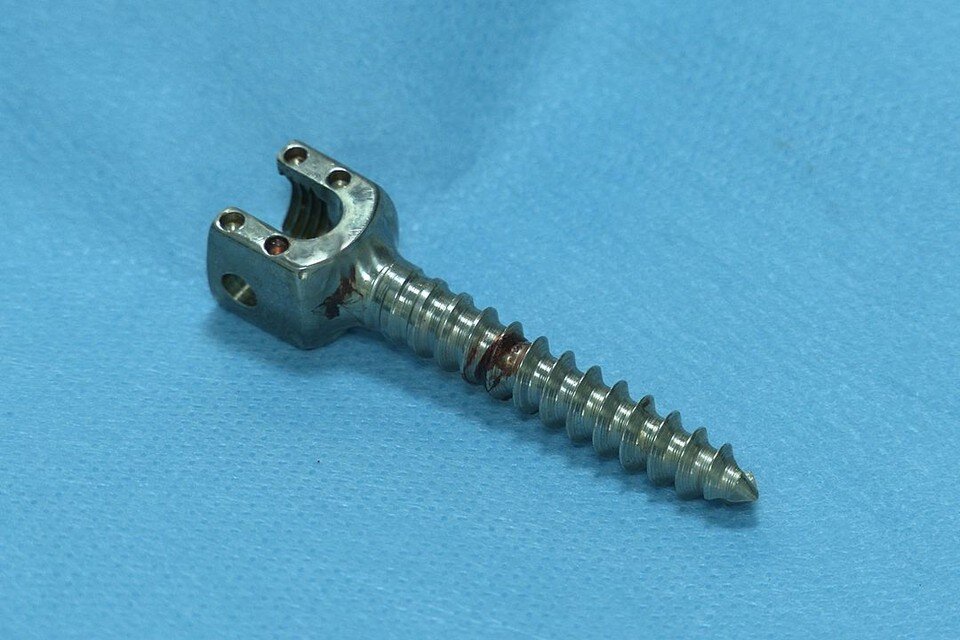     Вот такую деталь достали хирурги из тела пациентки. Фото: Центр имени Мешалкина