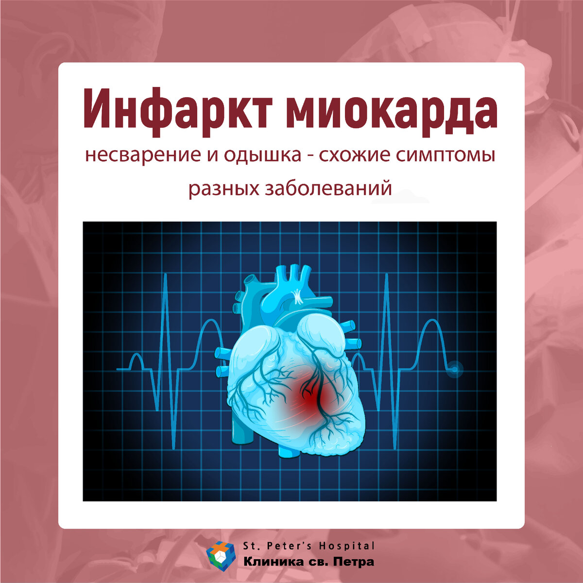 Стеснение в груди, несварение могут быть инфарктом миокарда | Клиника св.  Петра (г. Сеул) | Дзен