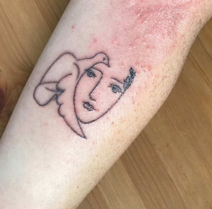 Появились прыщи на татуировке, что делать?