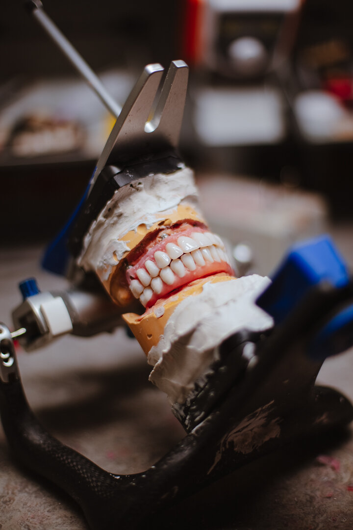 фото зубы за 1 день