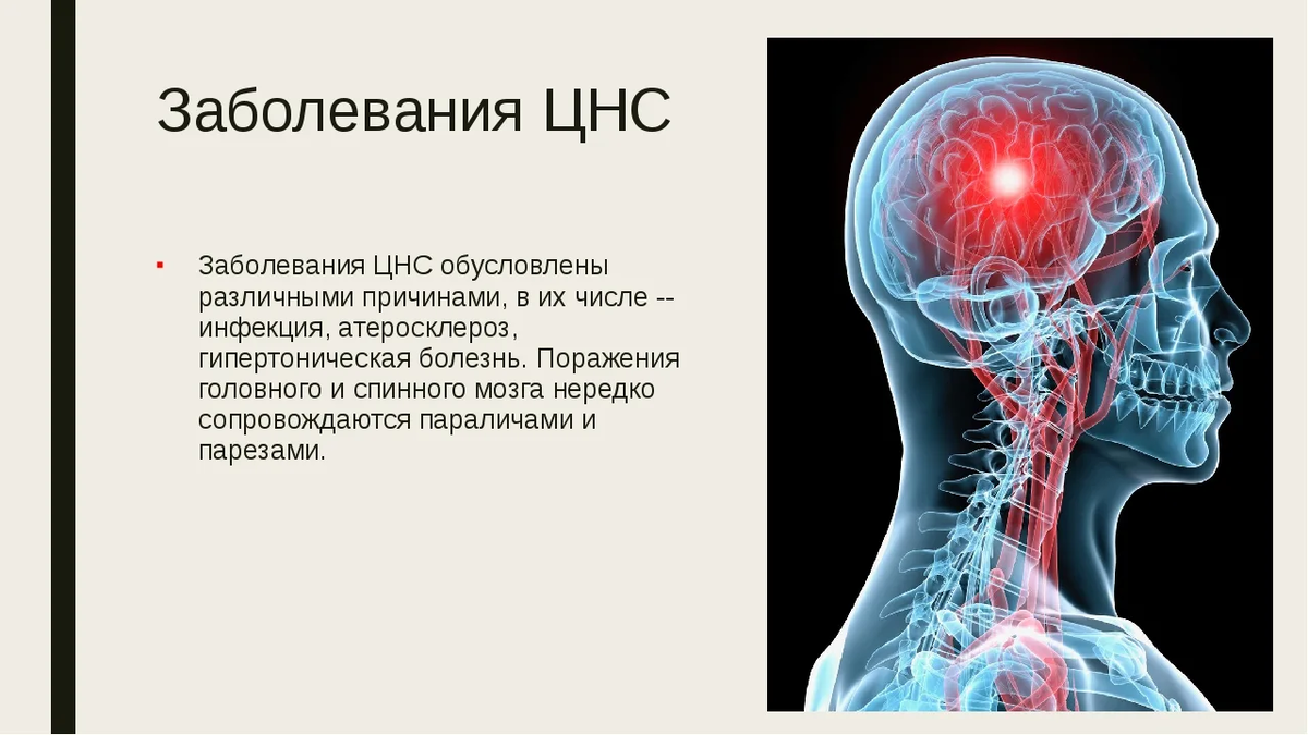 Сосудистые заболевания головного мозга неврология презентация