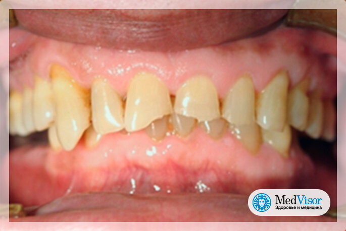  Designed by Dr. A. Dickson/wikimedia