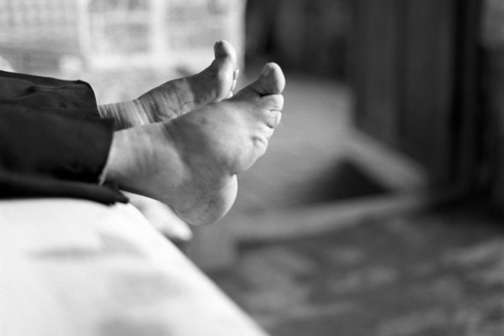     В Китае девочкам столетиями уродовали ноги бинтованием. Вот зачем это делали