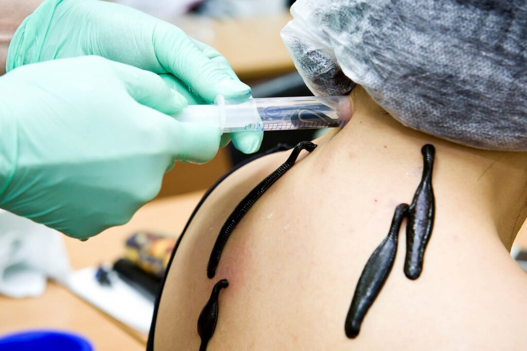 Фото: narcoff.com