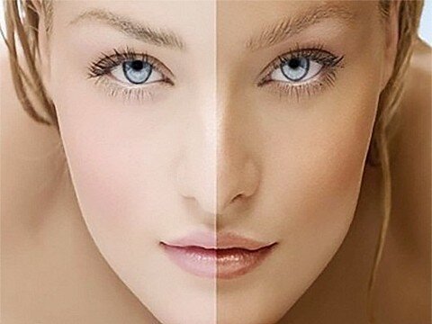 Землянистый цвет лица: причины серого оттенка у мужчин и женщин