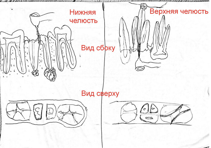Сага о стоматологии. Глава 30. Как удаляют сложные зубы? Как ...