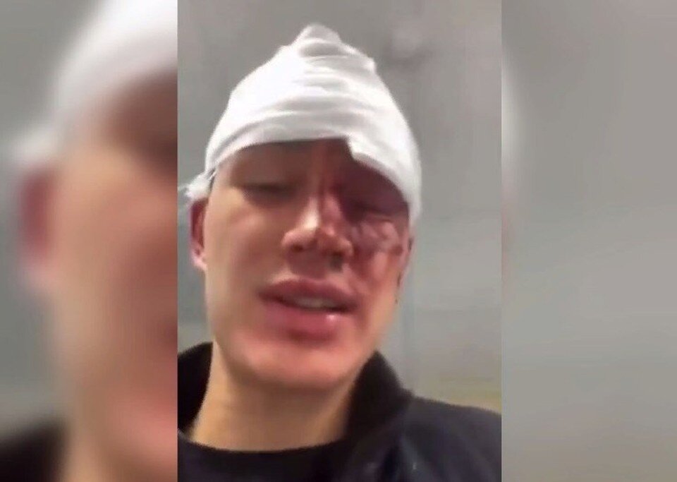     На следующий день после потасовки.  Предоставлено «КП – Владивосток»