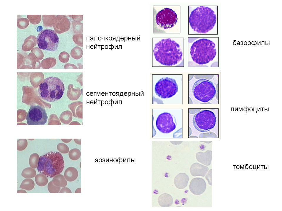 Палочкоядерные нейтрофилы препарат. Функции сегментоядерных, эозинофилов. Палочкоядерные нейтрофилы микроскоп. Юный нейтрофил препарат.