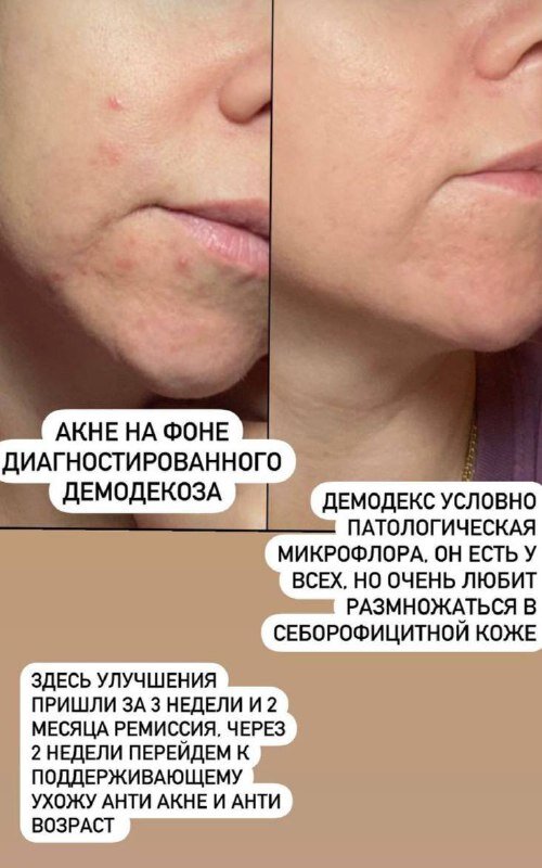 Клиентка после домашней коррекции 