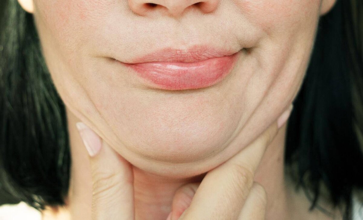 Как убрать второй подбородок | Face Clinic | Клиника косметологии в ...