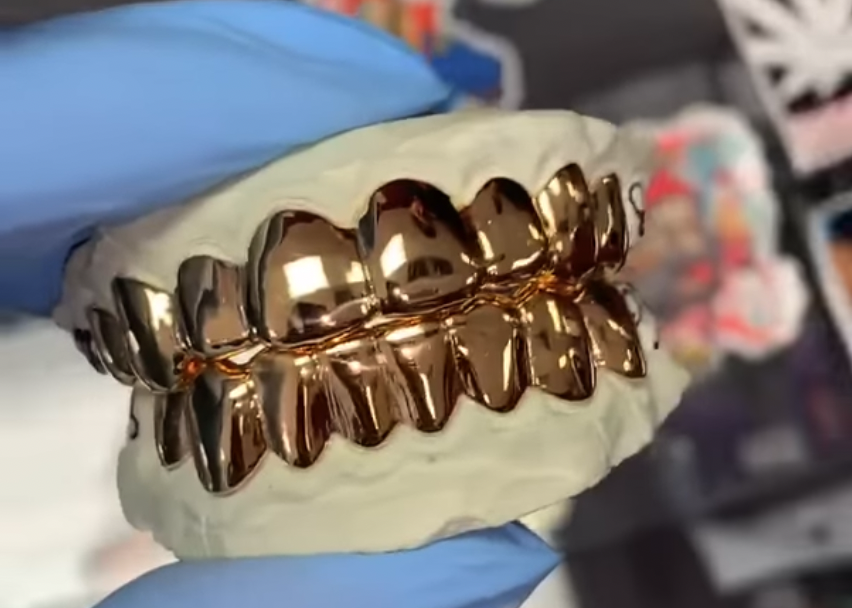 Грилзы из золота 22 карата