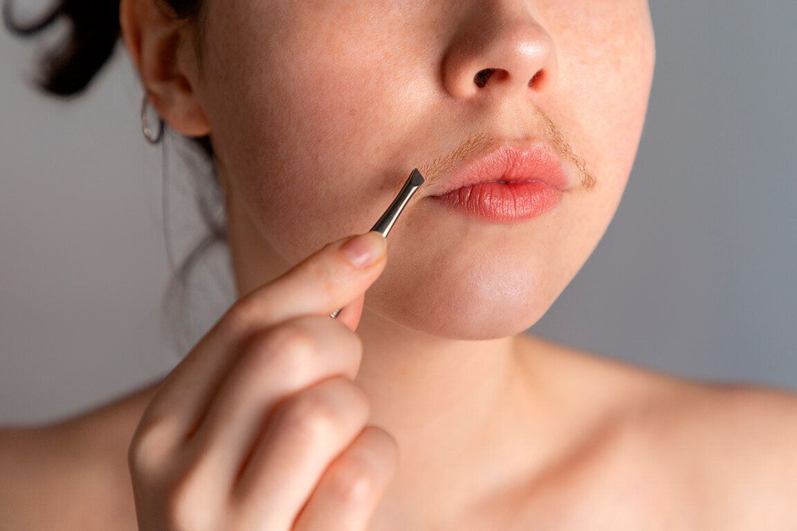     7 причин появления «лишних» волос на лице и теле