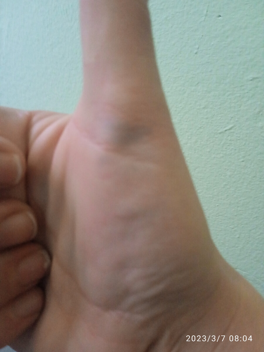 Не знаю что за проявление.