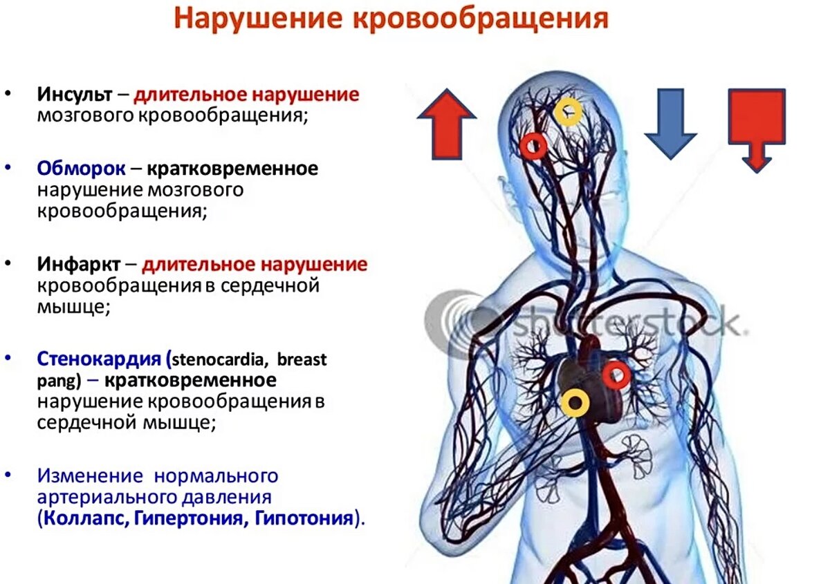 Общие нарушения кровообращения