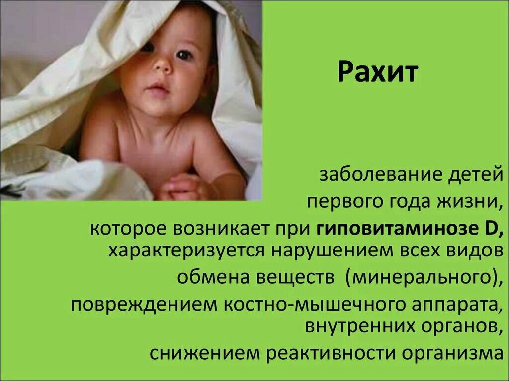 Признаки рахита у детей до 1 года – на что обратить внимание родителям — клиника «Добробут»