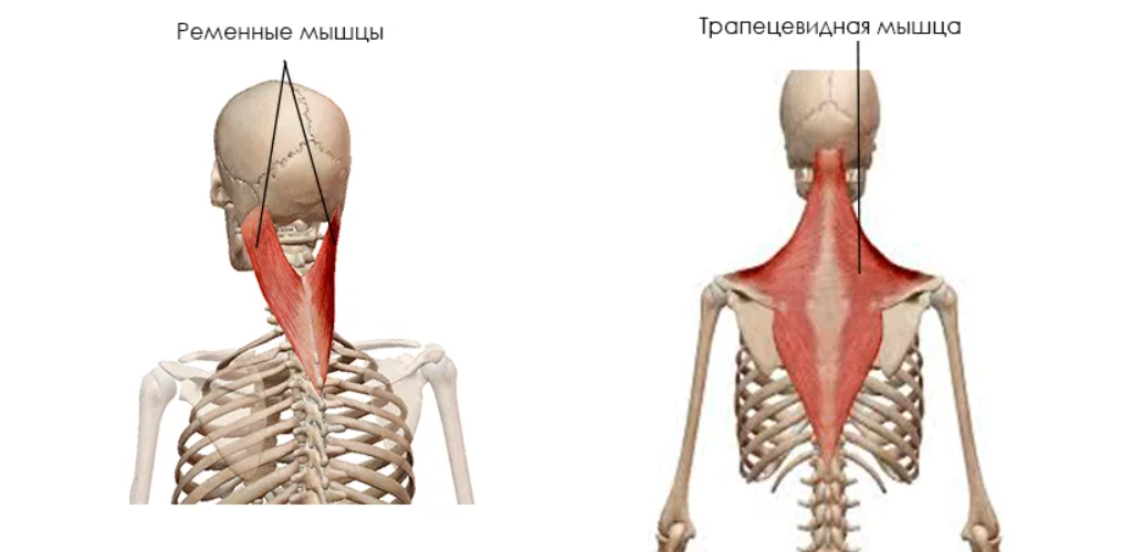 Защемление седалищного нерва