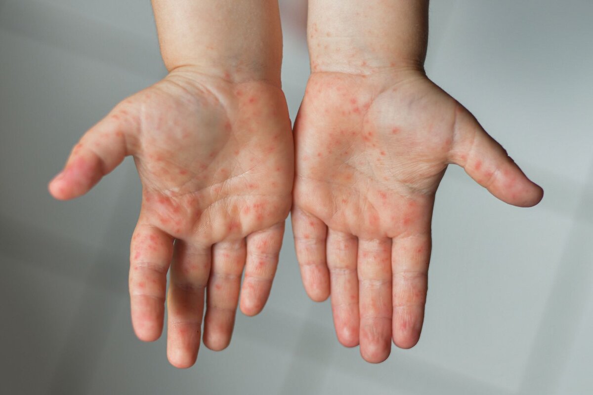   Фото: istockphoto.com