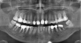 взято с общего доступа