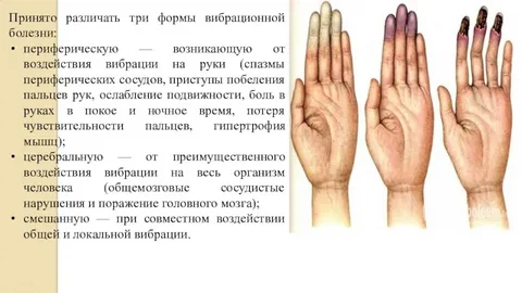 взято из общего доступа