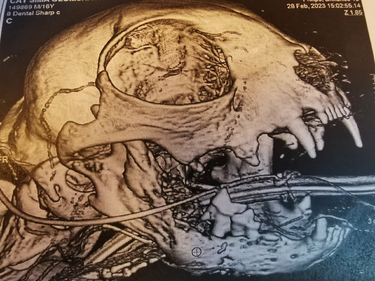 Изменённая структура кости на КТ. Фото из личного архива автора. 