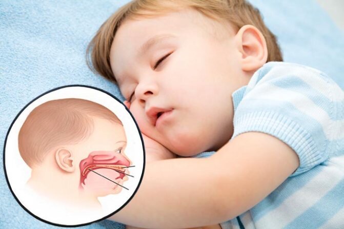 Почему ребенок задерживает дыхание во сне – полезные статьи о сомнологии