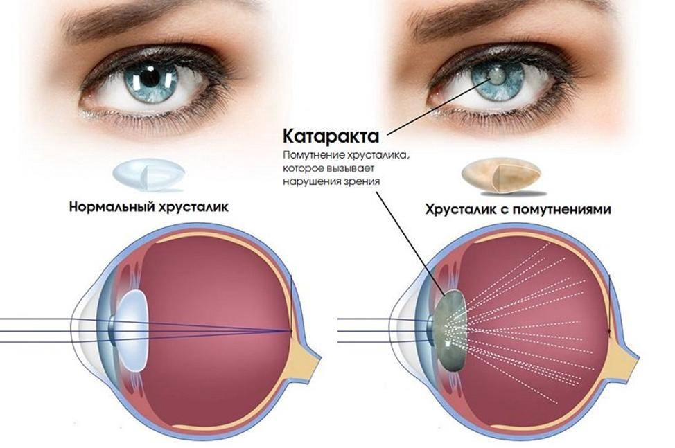 После как мы видим