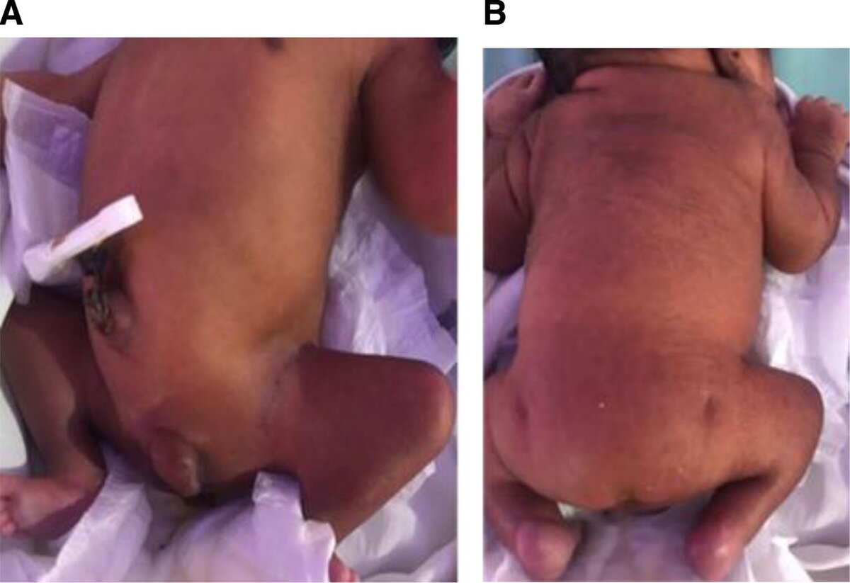   Karim Premji Manji et al. / BMJ Case Reports, 2023