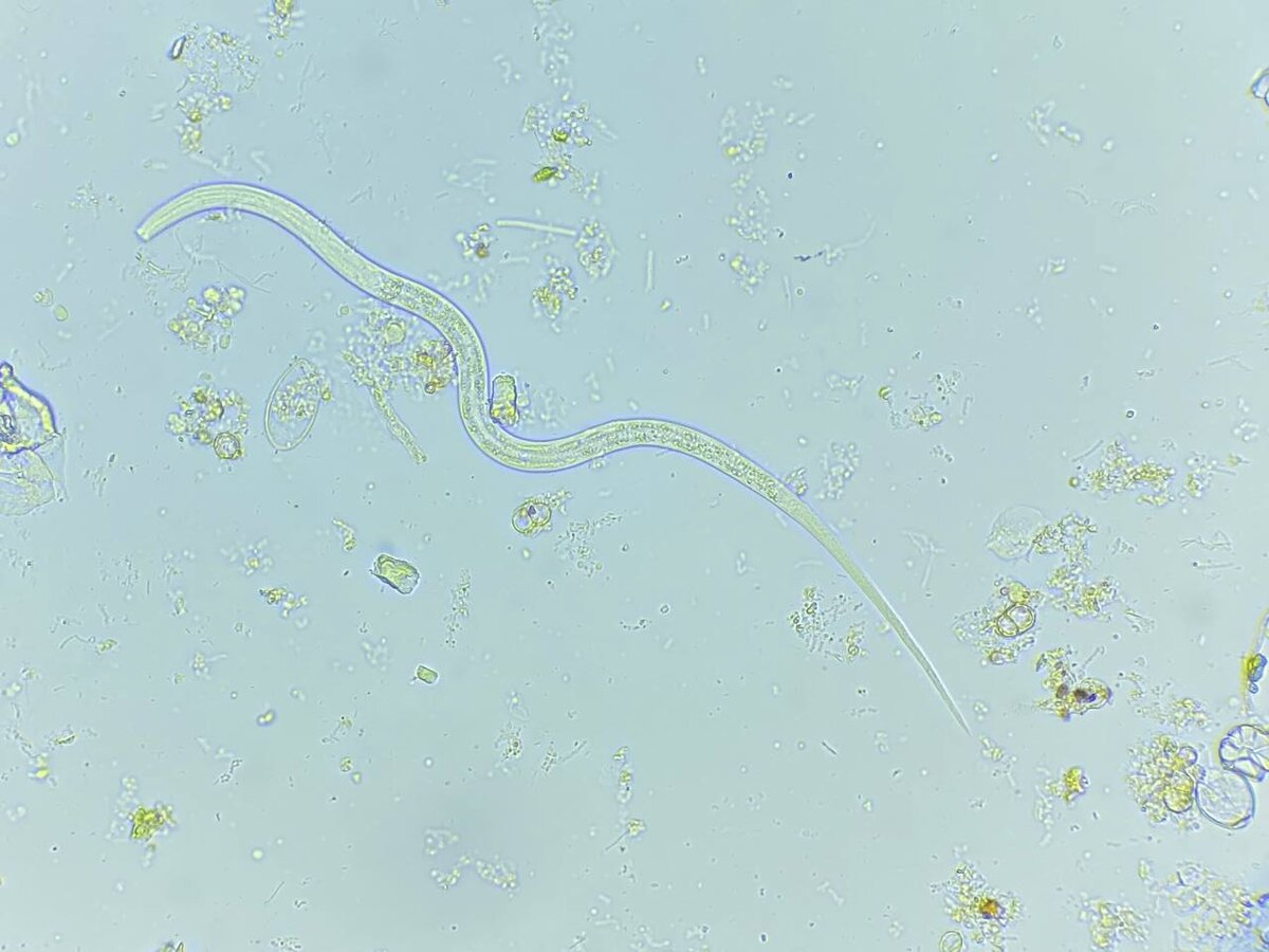 Угрица кишечная, увеличение 400Х