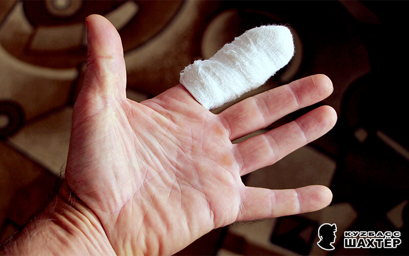 Фото автора. Бытовая рана оказалась довольно серьёзной, без перекиси водорода и бинта дело не обошлось.