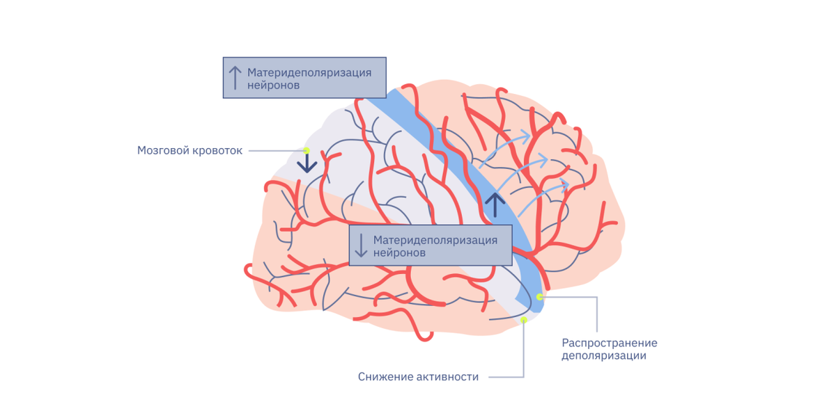  Распространяющаяся корковая депрессия. Источник: The Lancet. Neurology
