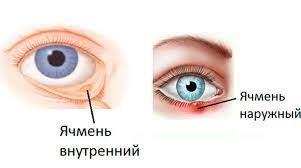 взято с общего доступа
