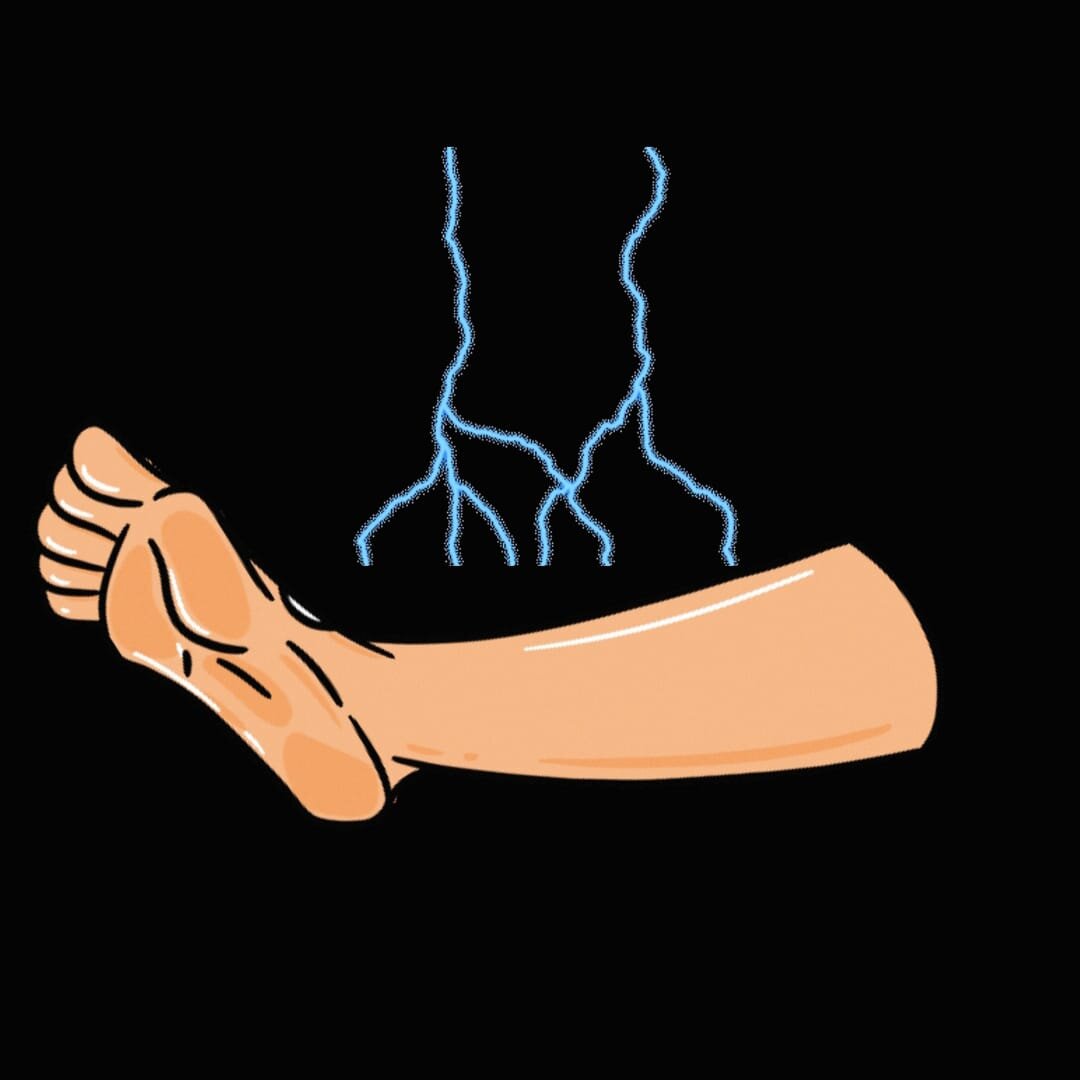 Ночные судороги в икрах | Кратко. По сути | Дзен