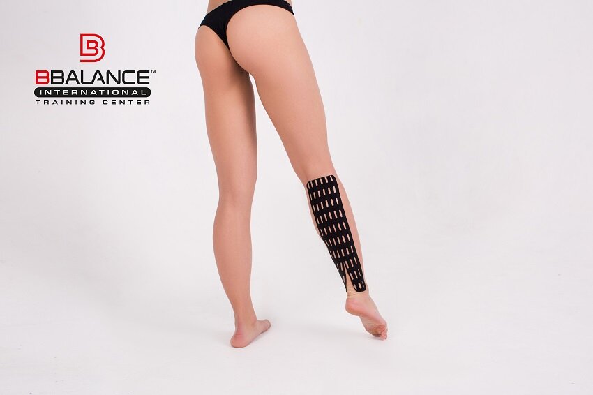 Кинезиотейпирование при варикозе 