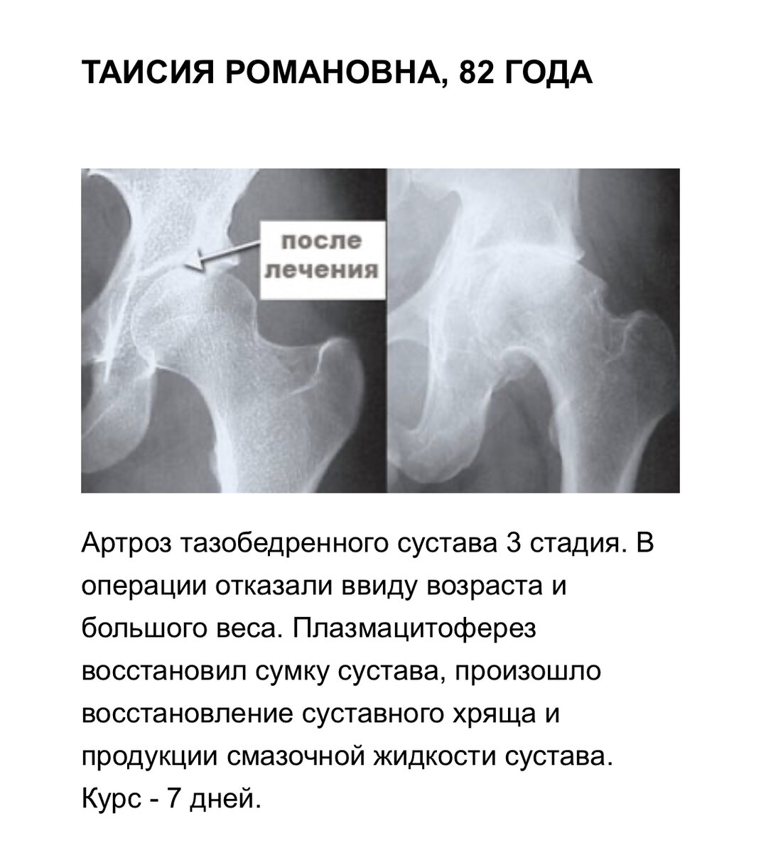 Повезло Таисии Романовне!!