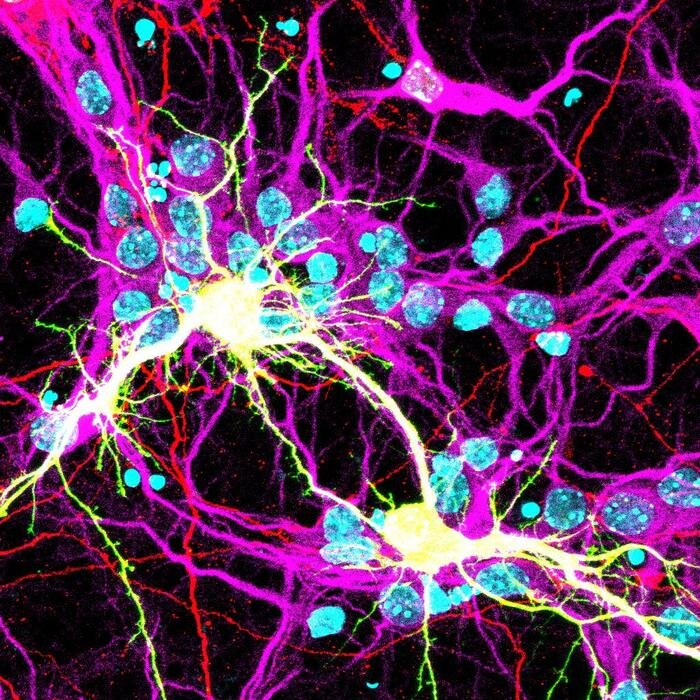 Нейроны головного мозга. Мозговые клетки. Слияние клеток. Клетки мозга виды