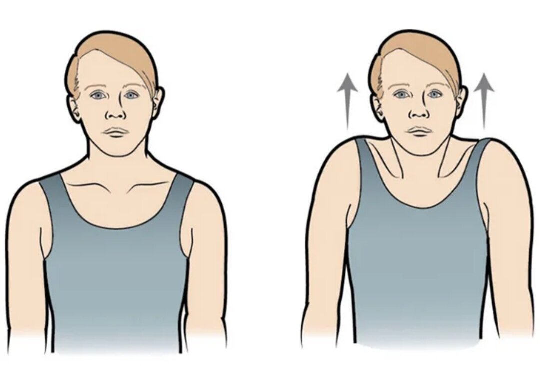 Голова вперед. Пожимание плечами упражнение. Поднятые плечи. Втягивание головы в плечи. Голова втянута в плечи.