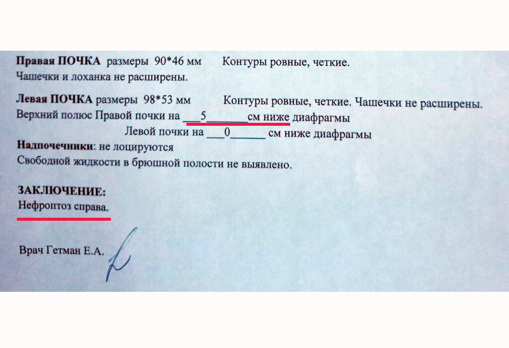 Результаты УЗИ 2022 года, листайте галерею