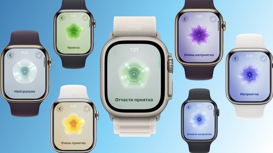    Apple Watch