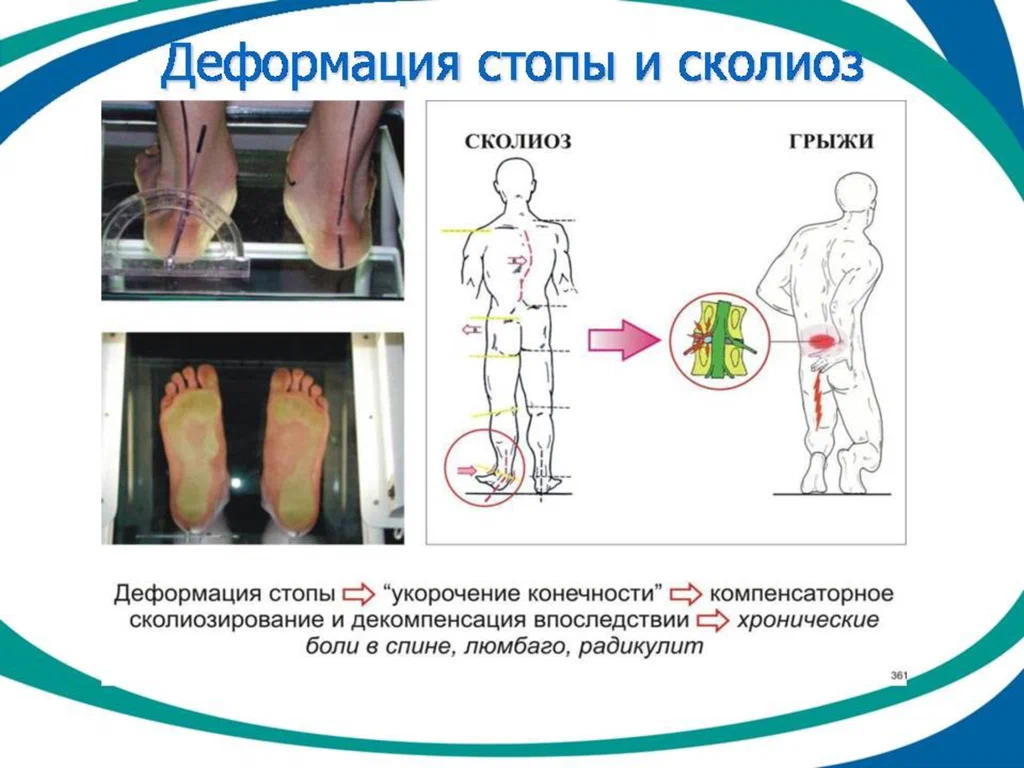 Врачи моей мечты. История боли в шее. | Здоровы и Счастливы | Дзен