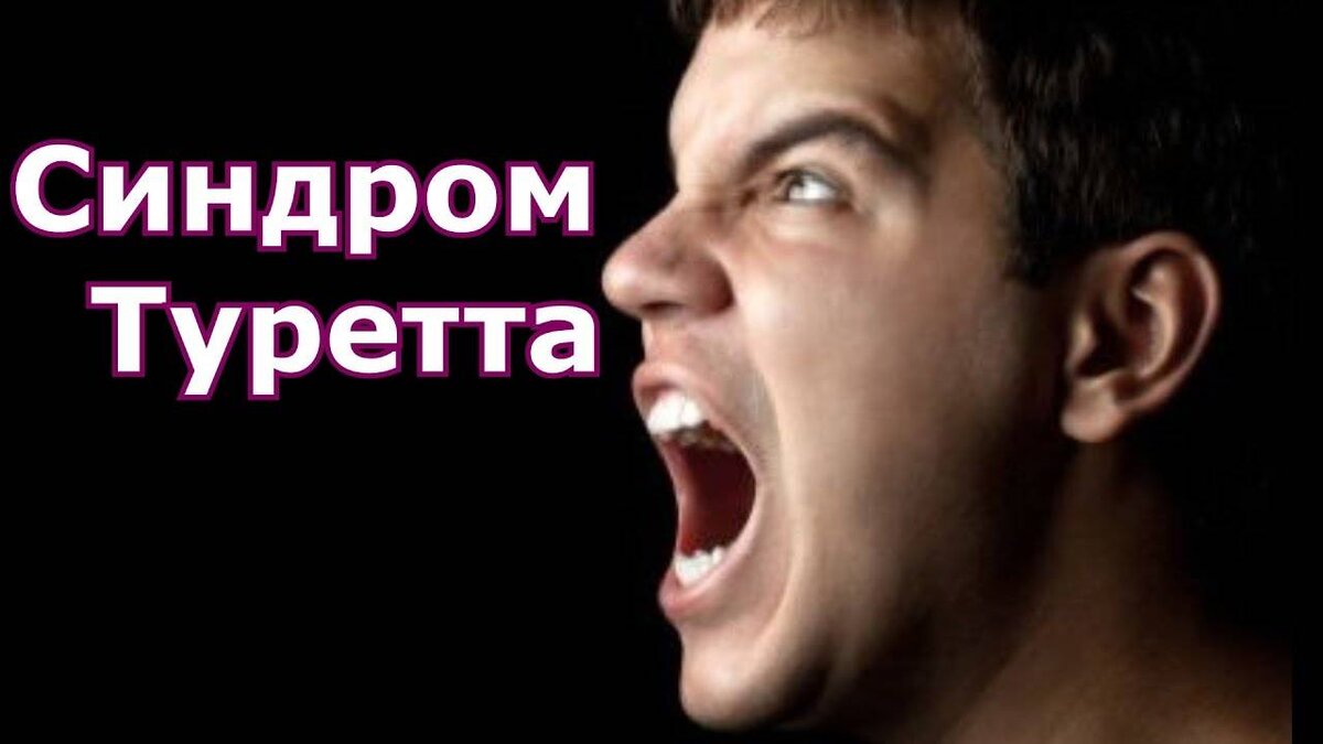 Синдром туретта картинки