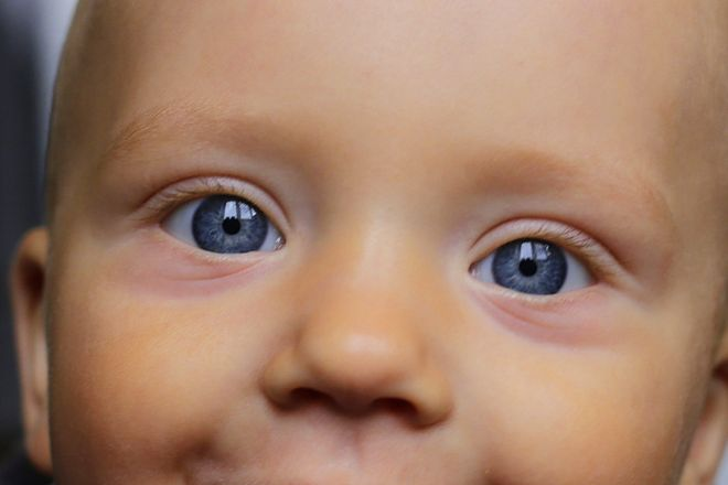 У ребенка темные круги под глазами почему. Мешки под глазами у ребенка. Круги под глазами у грудничка. Кровоподтеки под глазами у ребенка.