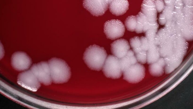    Бакпосев сибирской язвы ©Todd Parker, Ph.D., Assoc Director for Laboratory Science, Div of Preparedness and Emerging Infections at CDC. Общественное достояние Wikipedia.org