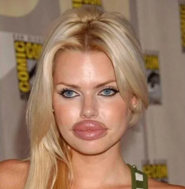 силиконовые губы. губы накаченные ботоксом. силиконовые губы. губы накаченные ботоксом. сандра губастая.