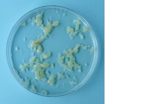 Рисунок 2. Ткани эмбриона на 4 неделе беременности женщины