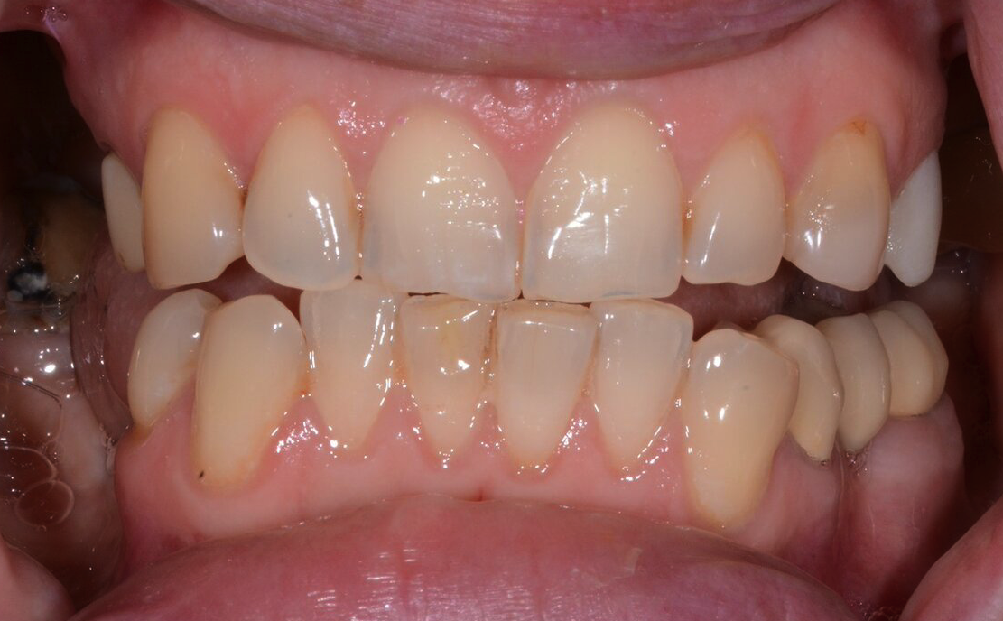 С таким исходном к нам пришла пациентка.